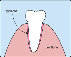 Educational dental diagram showing tooth structure with gum tissue and bone loss illustration