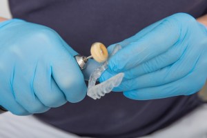 Dentist's hands in blue gloves holding dental implant abutment during procedure